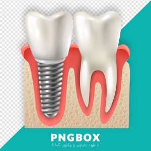 تصویر دندان و ایمپلنت PNG